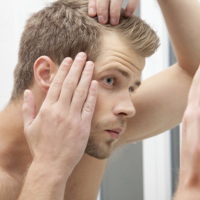 Handsome young man worried about hairloss