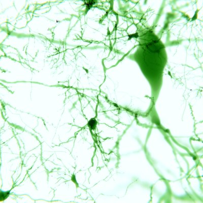 Pyramidal neurons