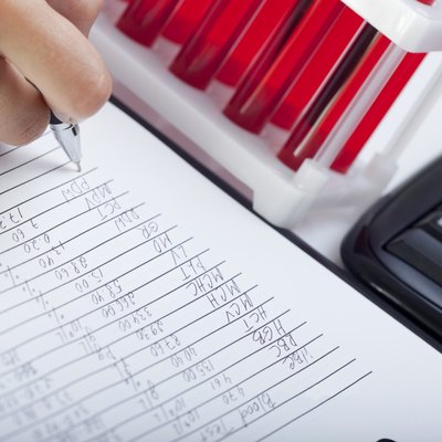 Doctor's medical notes and blood samples.