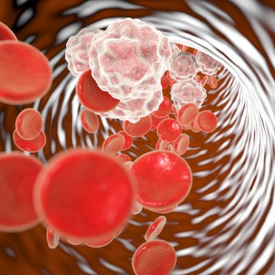 Blood in patient with inflammation