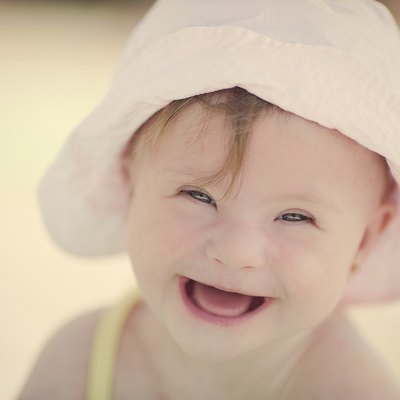 cheerful little baby girl with Downs Syndrome