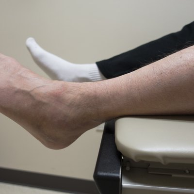 Broken Foot, Sprained Ankle, Fractured Bone in Doctor's Exam Room
