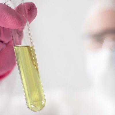 Urinalysis