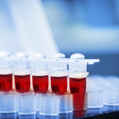 Blood samples