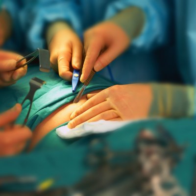 close-up of surgeons hands making an incision in a patient