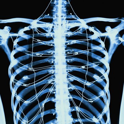close-up of an x-ray of a image human chest area