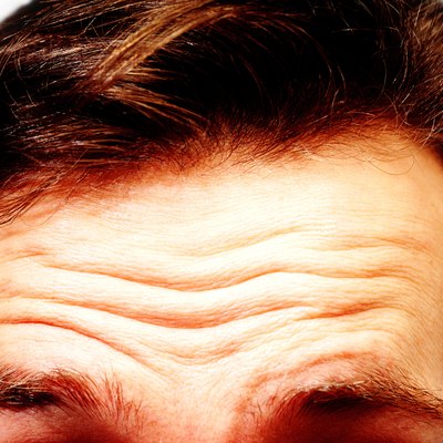 Man's Hairline