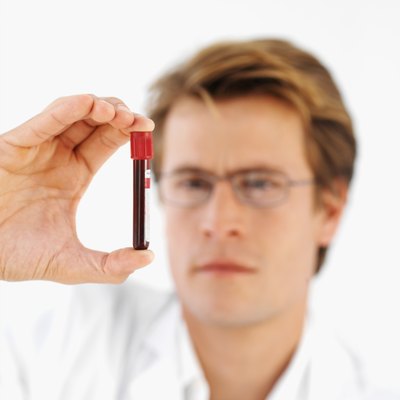 Close-up front view of a doctor holding blood sample