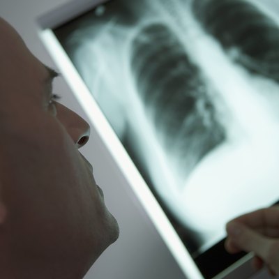 Male healthcare worker looking at x-ray, with person's hand on side of image