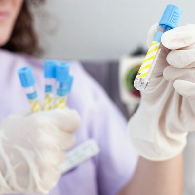 Nurse with Vials of Blood Samples