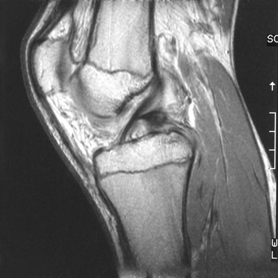 Scan of a human knee