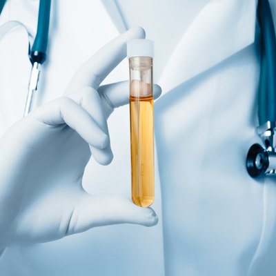 Doctor holding urine sample