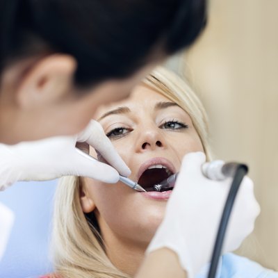 Dental Work on Teen - Teeth Polishing