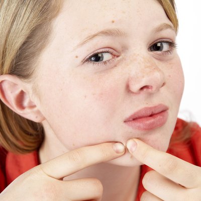 Teenage girl picking at acne