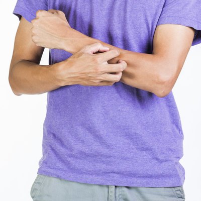 Young man having itchy and dry skin problem