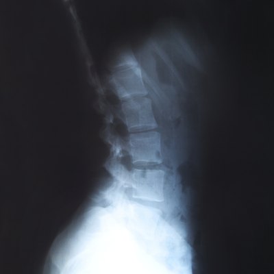 spine x-ray
