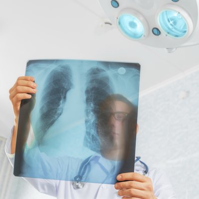 Doctor looks at x-ray image