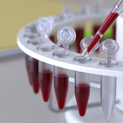Laboratory blood test
