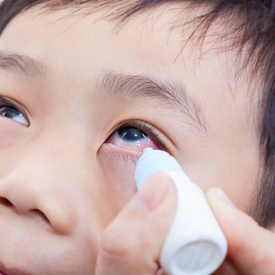Closeup of parent pouring eye drops in eye her son