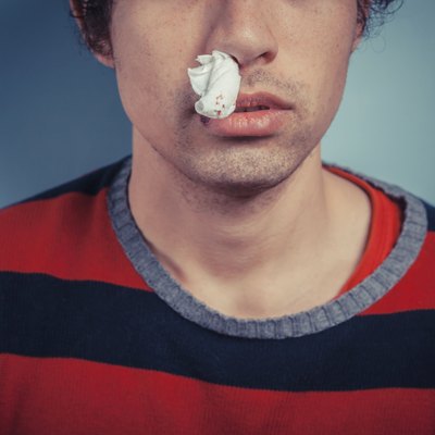 Man with nose bleed and cold sores