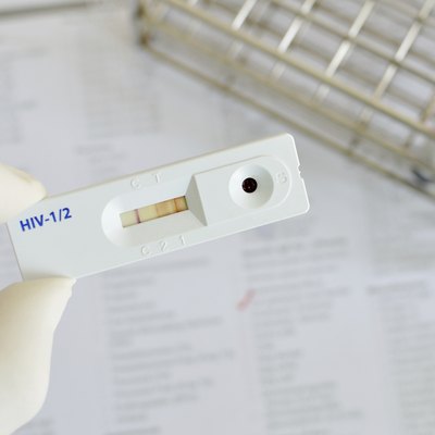 HIV positive