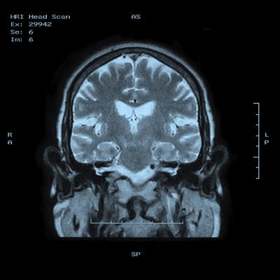 MRI Head Scan Back view