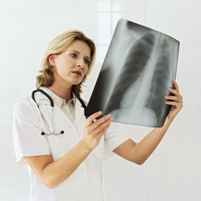 female doctor examining an x-ray