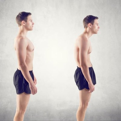 Man with impairMan with impaired posture position defect scoliosis and ideal bearing.