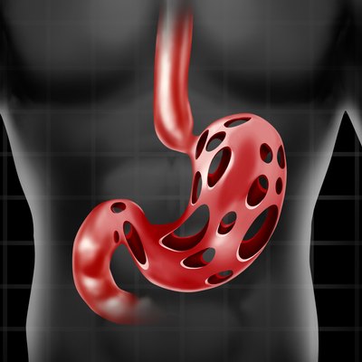 Stomach Problem