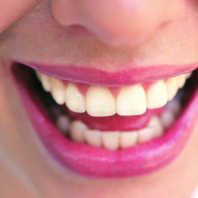 Close-up of Woman's Teeth