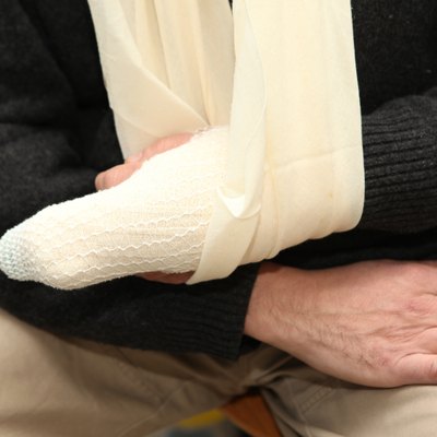 Broken finger