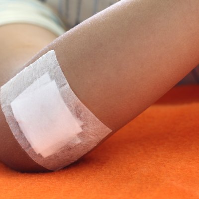 Wound sealed with plaster