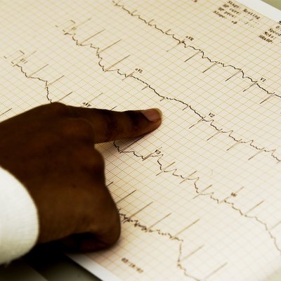 Technician monitors EKG machine