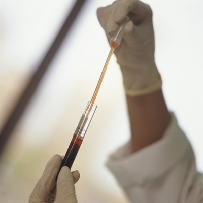 Technician working with blood sample at blood bank, Close-up of hands