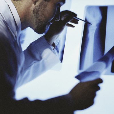 Male doctor examining an X-ray