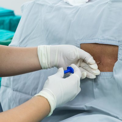 spinal nerve block