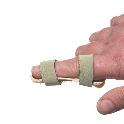 Broken Finger