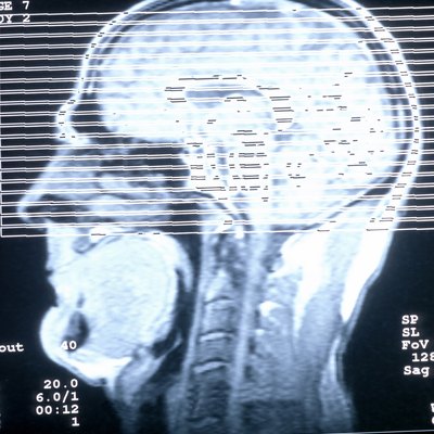 CAT scan of human head