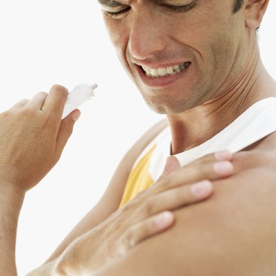 Young man applying ointment to his shoulder