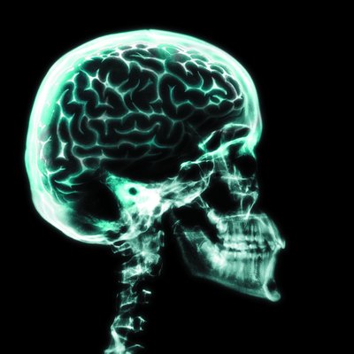 X-ray of brain in skull