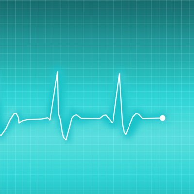 ECG