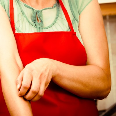 Woman scratching itchy arm. Allergy.
