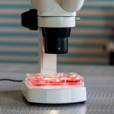 blood test in medical laboratory bench with microscope