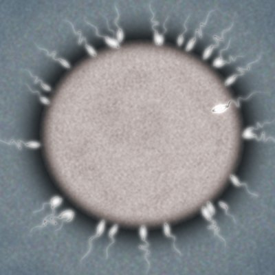 Sperm fertilizing ovum