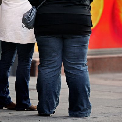 Scottish Government Annouce Plans To Deal With The Time Bomb Of Obesity