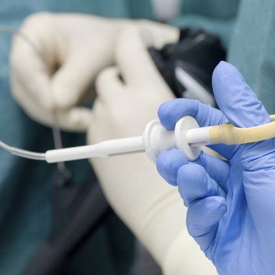 Endoscopic biopsy
