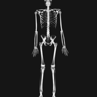 x-ray image of the full skeletal system of a person standing