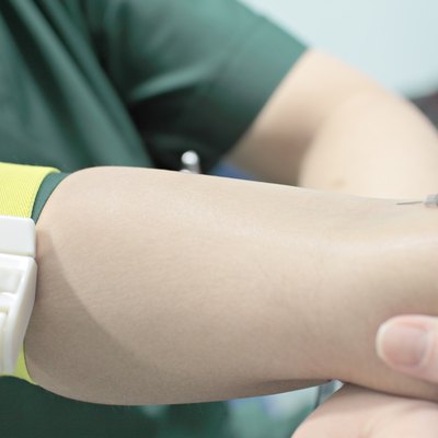 the process of vein puncture
