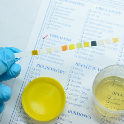 Urine analysis