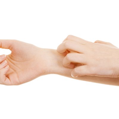 Itchiness